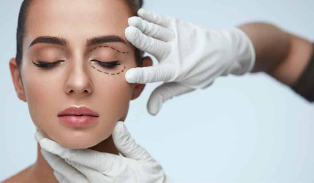 blefaroplastia